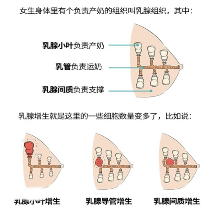 关爱女性健康｜体检单上的“乳腺增生”到底是什么？