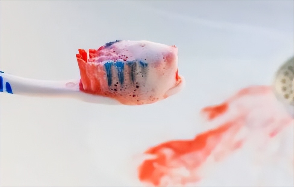 洗牙会伤害牙齿吗该不该洗牙,深度洗牙对牙齿有伤害吗