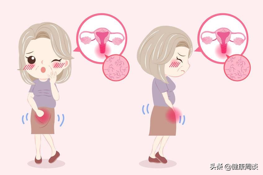 霉菌性阴道炎总是反复发作？多半是这4大习惯在作怪，需及早改掉