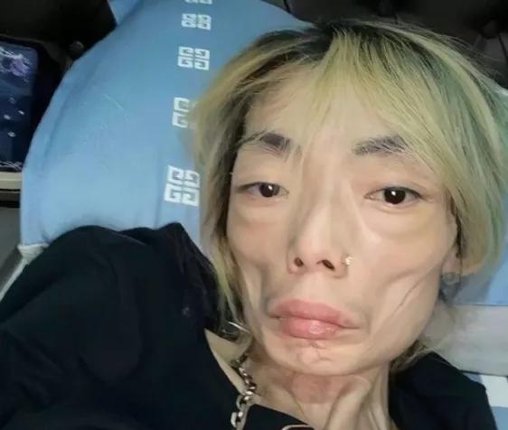 曾暴瘦到36公斤的女人,瘦了20斤就改变了她的一生