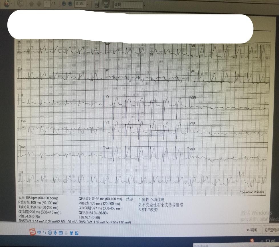 心血管疾病现代健康的杀手,年轻人当心心肌炎