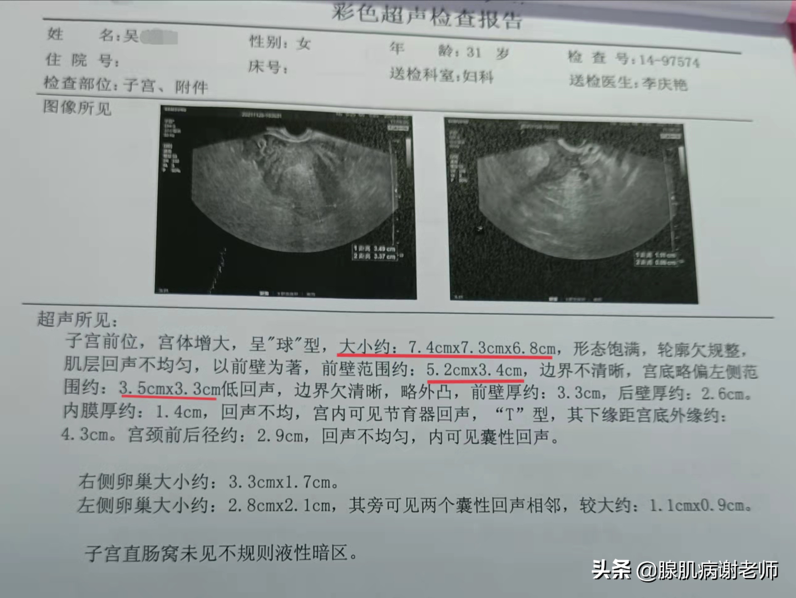 想想都难受，一个月时间体重增加10多斤，来姨妈要用卫生巾40多片