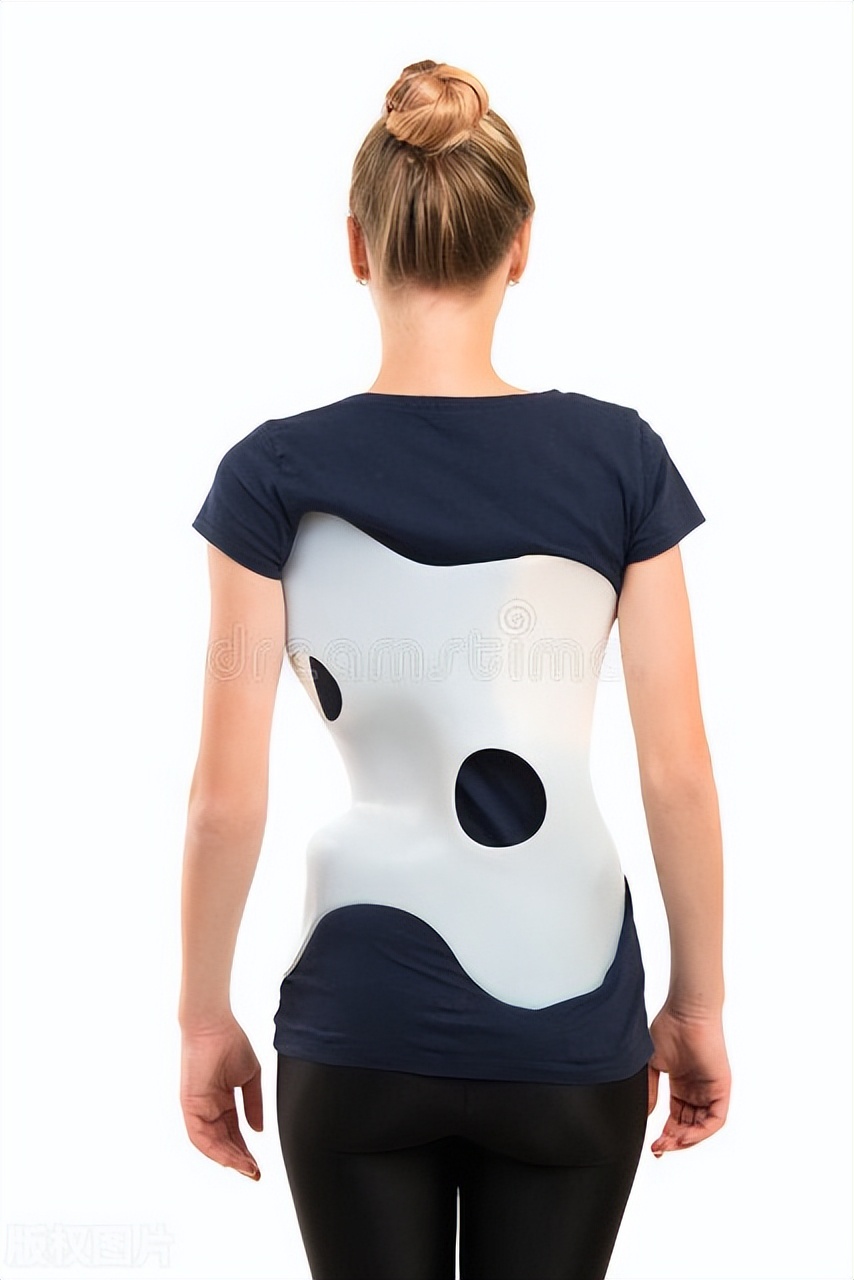 脊柱侧弯矫正器用3d扫描准确吗,脊柱侧弯矫正器成年人有用吗