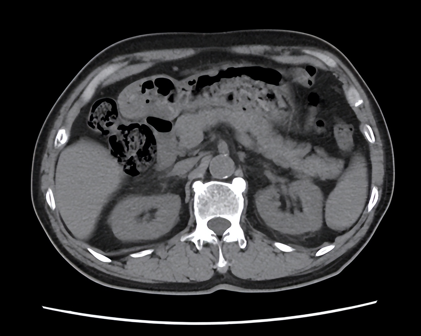 备孕女性尿频是怎么回事,尿频尿急尿血腰痛是肾炎吗