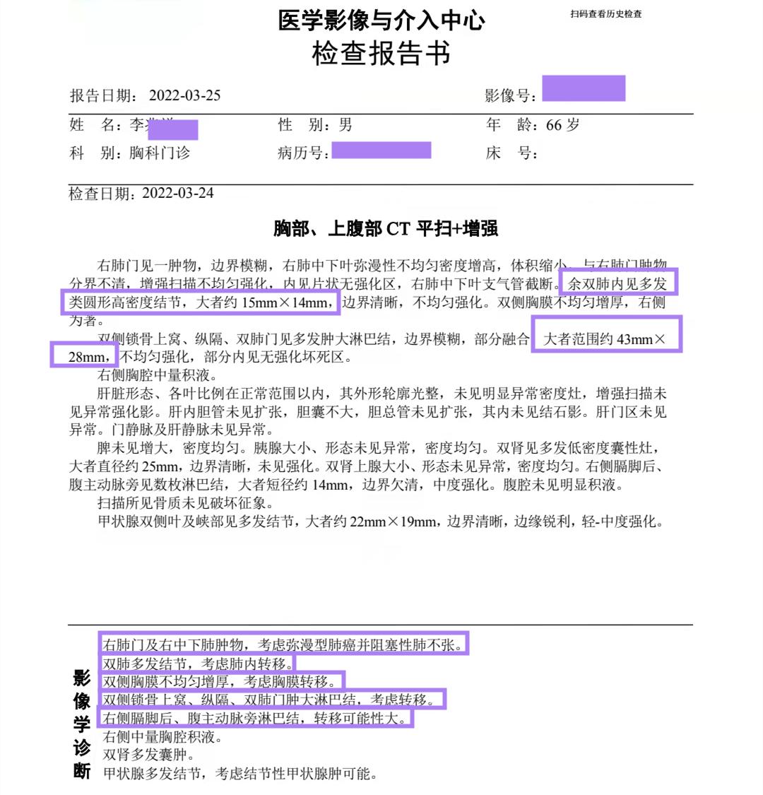 彭齐荣教授视频,专家说早期肺腺癌