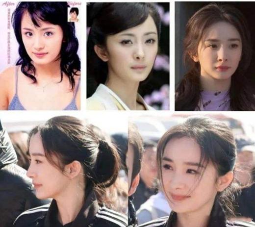 有一种倔强叫做没整容,有种倔强叫不承认整容