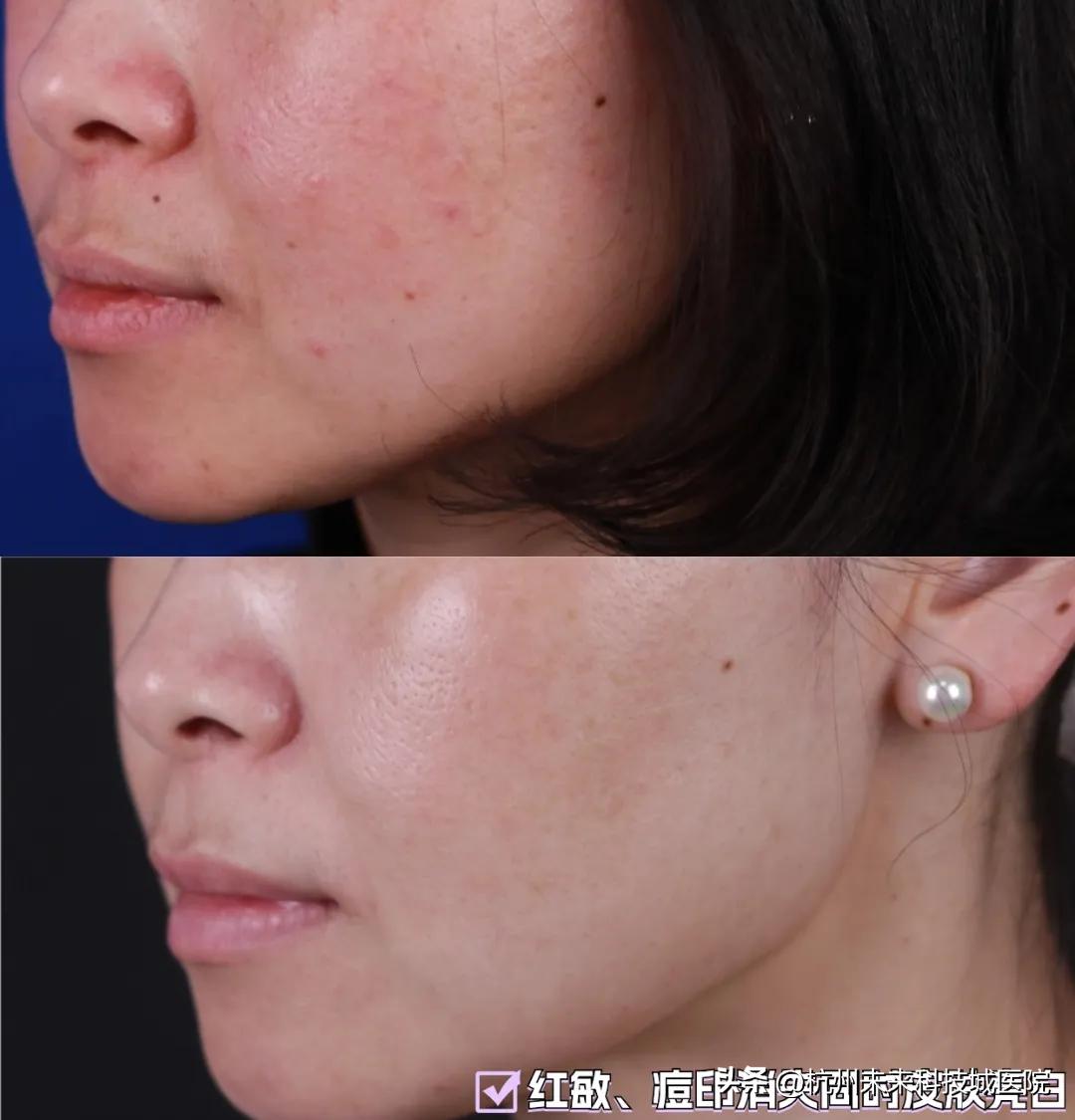 不追求一个模板的复制美|17年专注年轻化专家