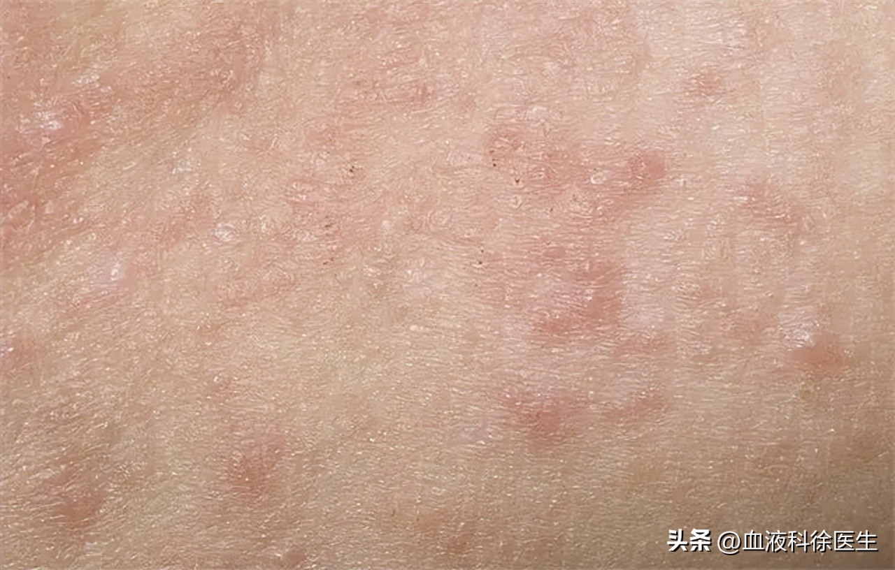 使用润滑剂的危害,使用润滑剂对胎儿的影响