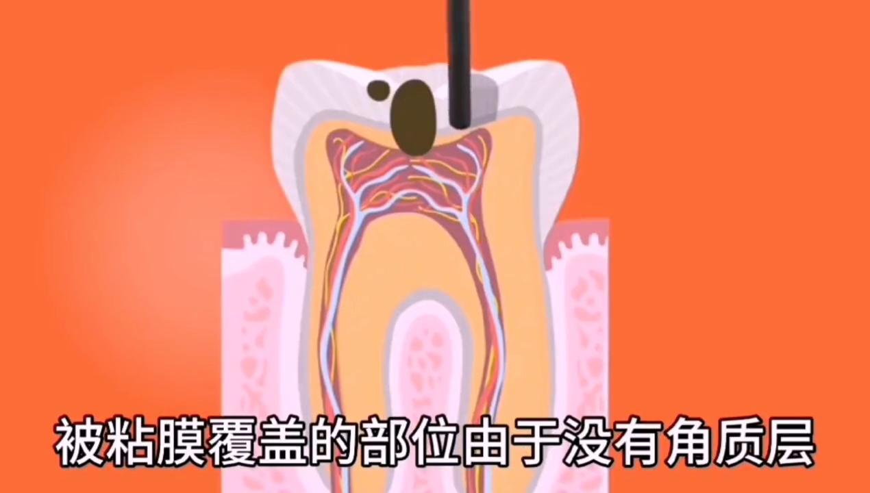 经皮毒有科学依据吗,经皮毒到底是什么东西