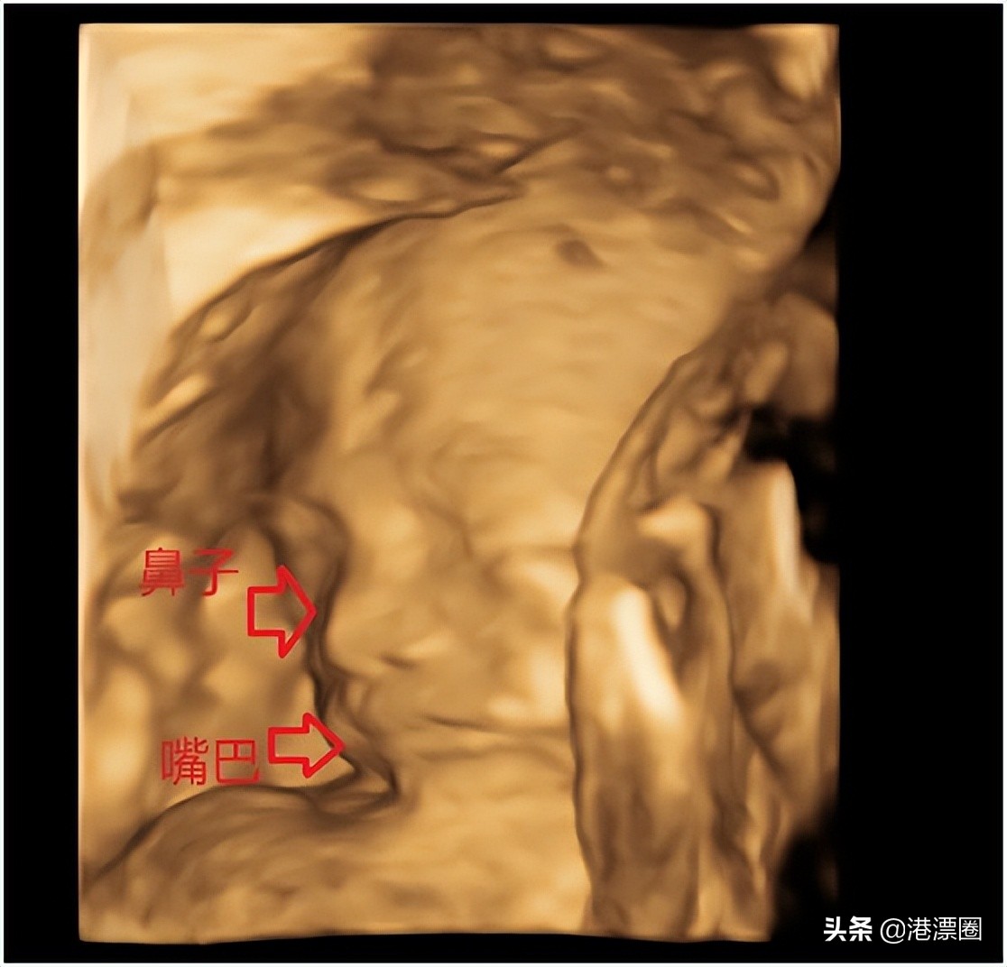 为了省点钱，我从香港私立转到公立生娃，肠子都悔青了