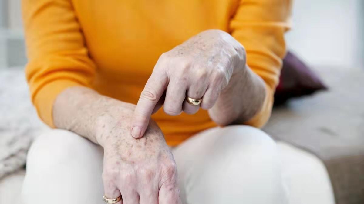 牙膏可以治老年斑是真的吗,牙膏能淡化老年斑吗