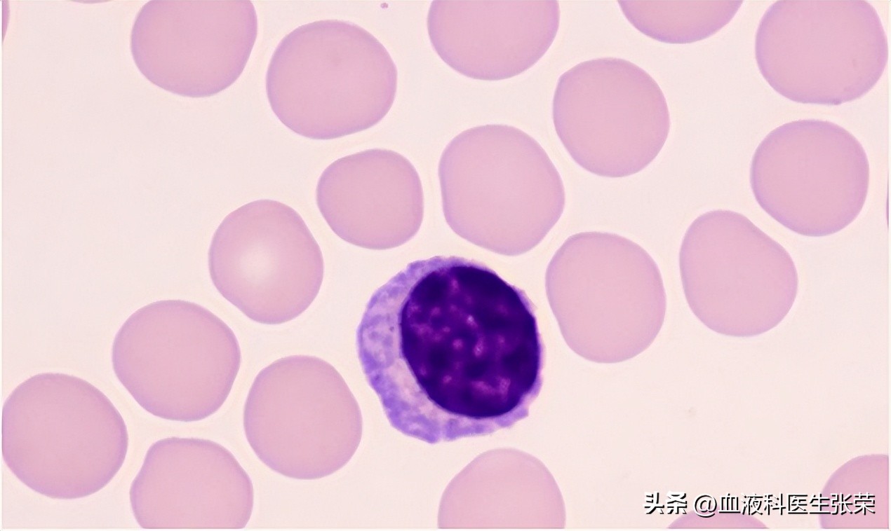 免疫功能紊乱血小板低,血小板减少凝血功能差如何调理