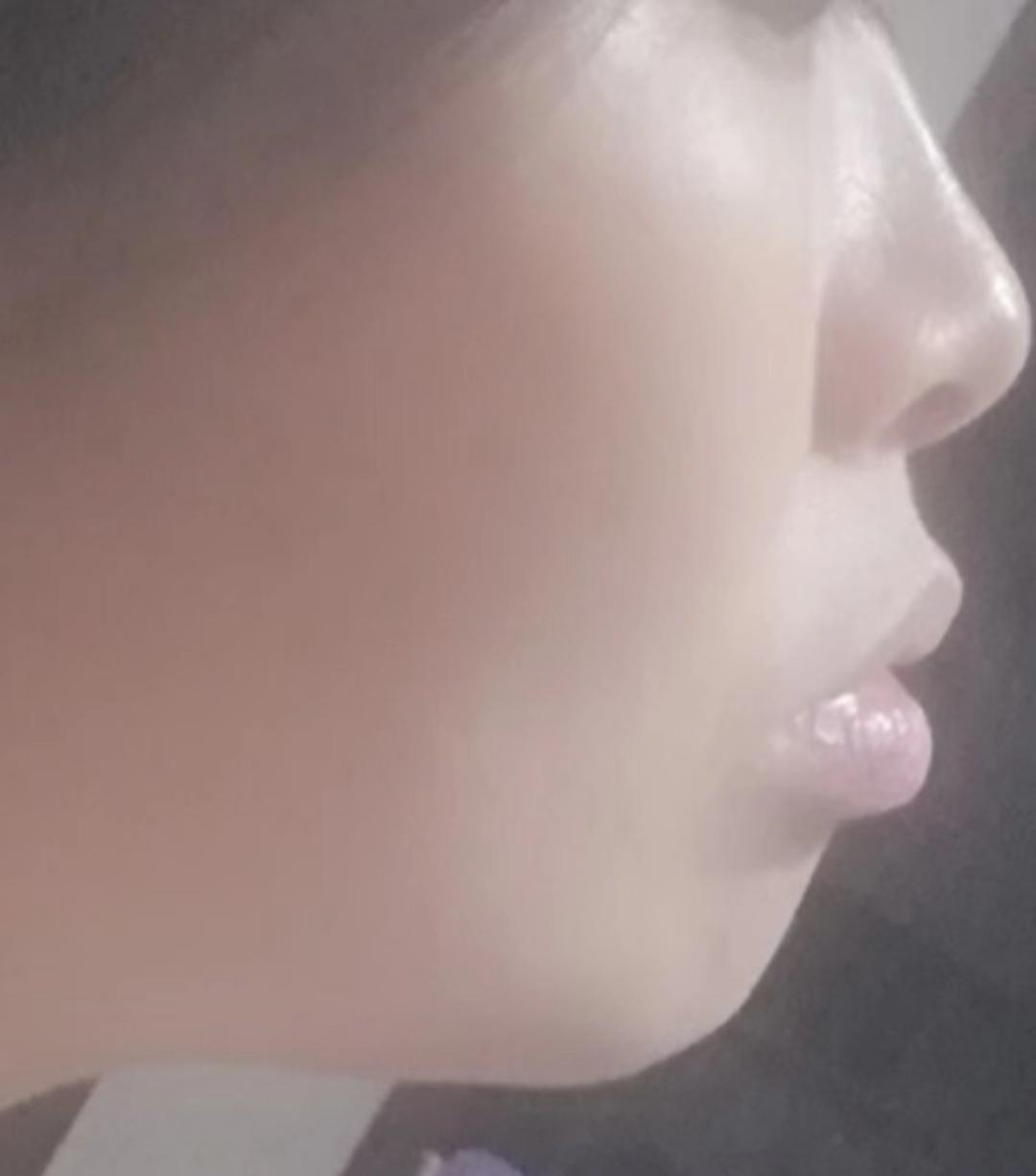 整牙亲身经历分享一下,整牙的经历分享