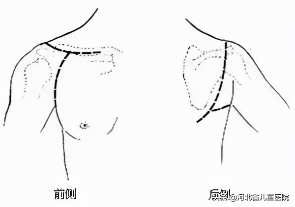 孩子的肩膀一个高一个低怎么回事,孩子肩膀一高一低怎样调节