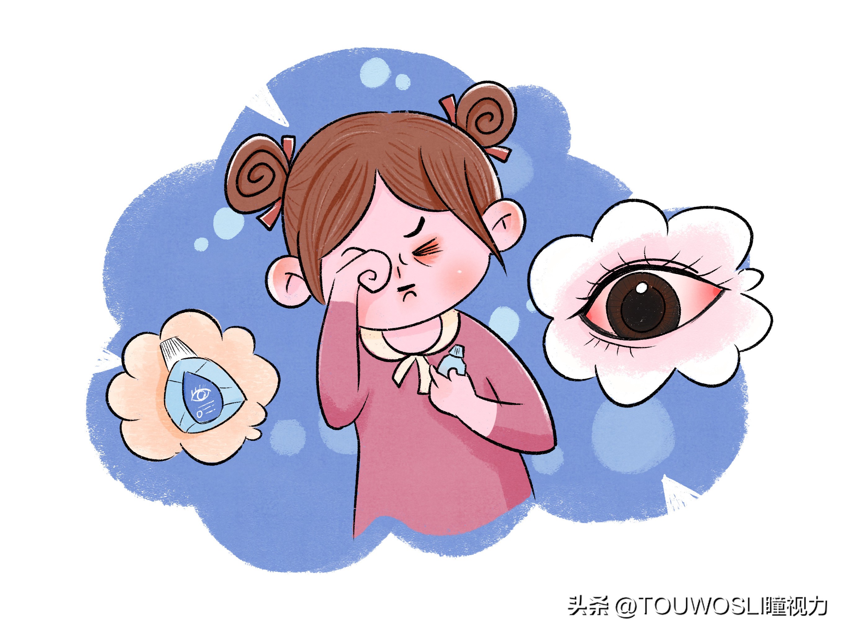 眼睛发痒干涩有异物感眼药水,鼻炎眼睛干涩发痒用什么眼药水