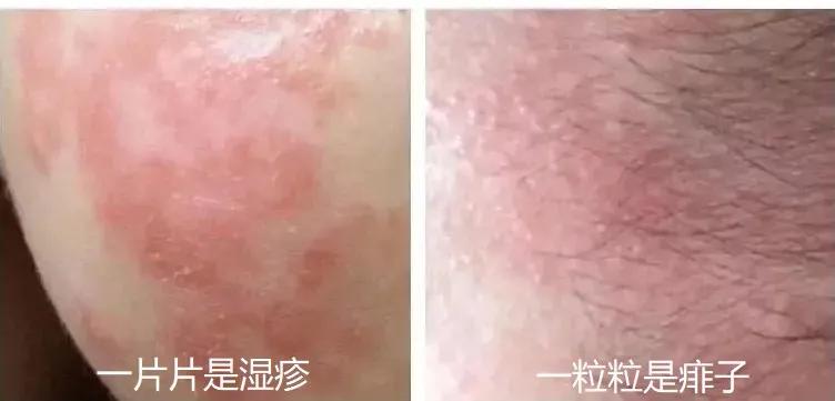 宝宝网红霜,用完宝宝霜长红疹了
