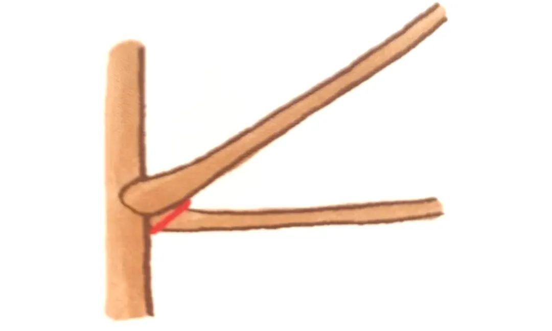 榆树盆景鸡爪枝修剪,映山红盆景花后怎样修剪枝