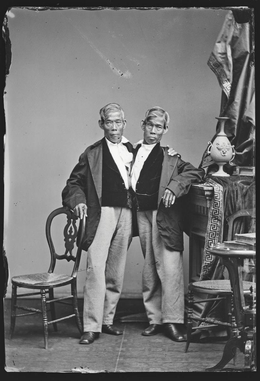 连体姐妹一人结婚现在如何,雌雄连体人结婚怎么办