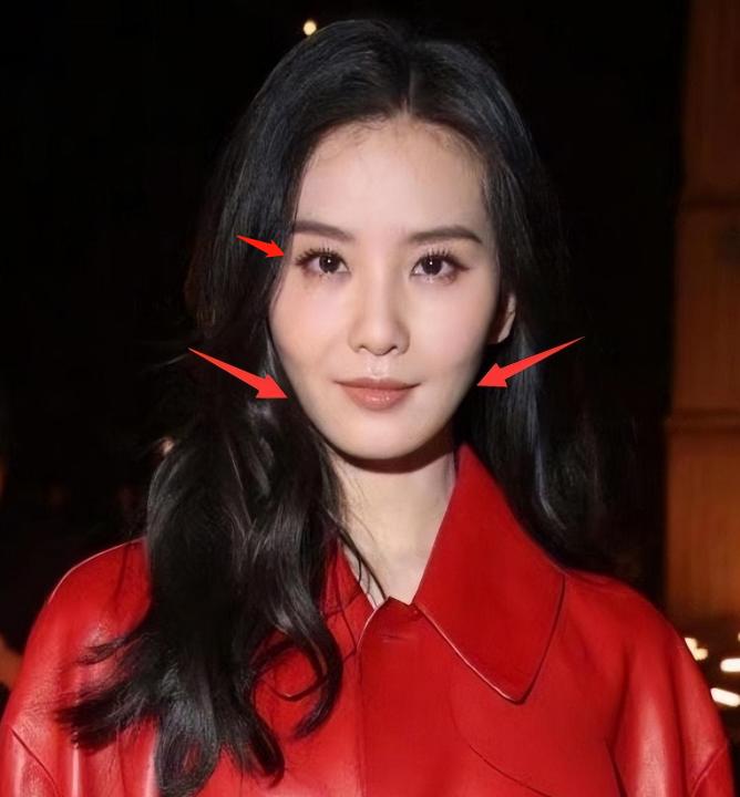 整容失败的女星蛇精脸,女星整容失败脸歪嘴斜