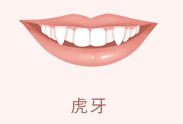 正畸医生为什么不建议植骨,正畸为什么医生不扶正智齿