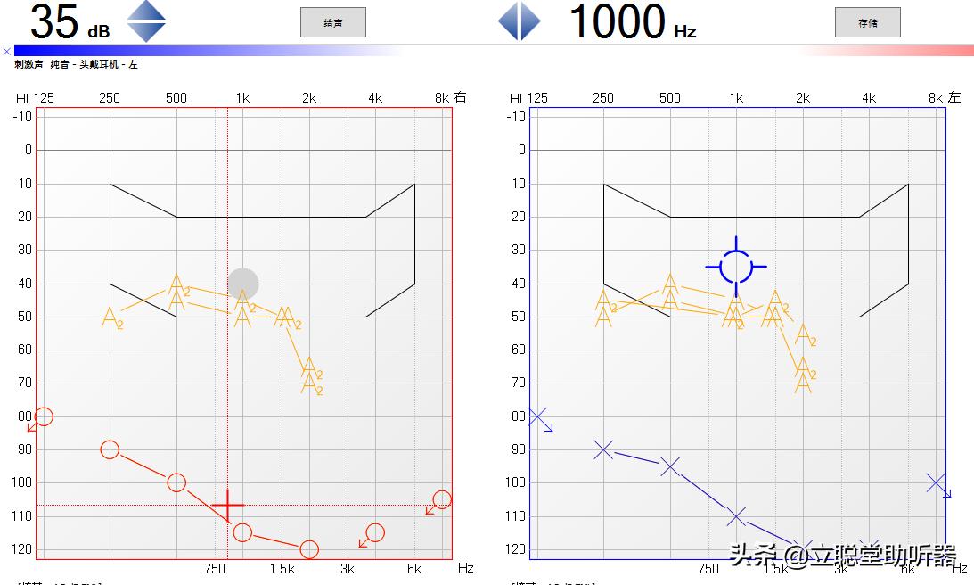 助听器为什么不能随便买一个,助听器有没有必要