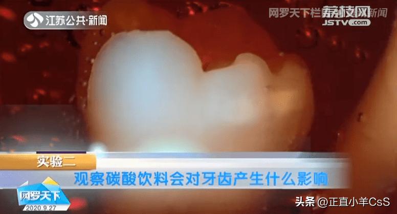 广西37岁孕妇,37岁广西孕妇