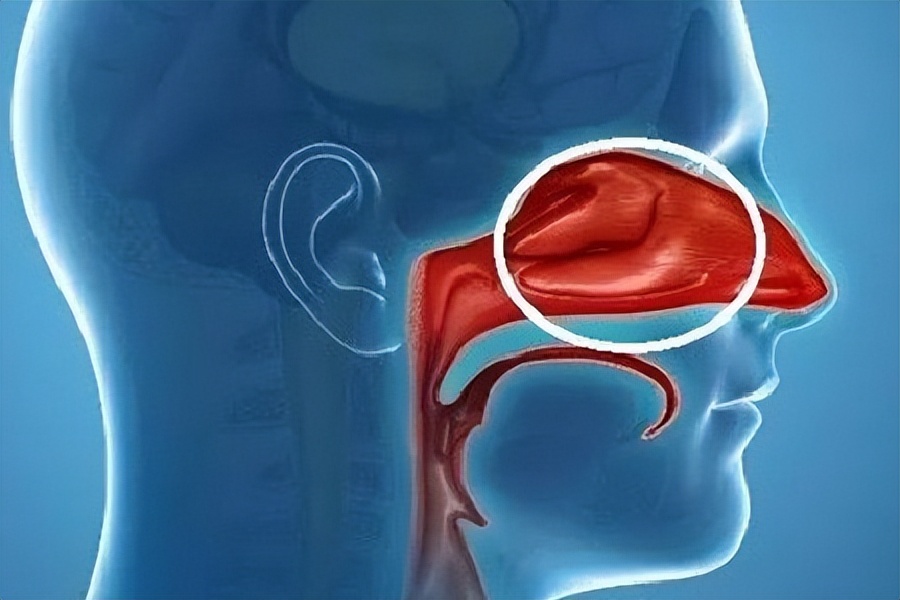 鼻毛窜出来该怎么解决,鼻毛窜出来后应该是剪掉还是拔掉