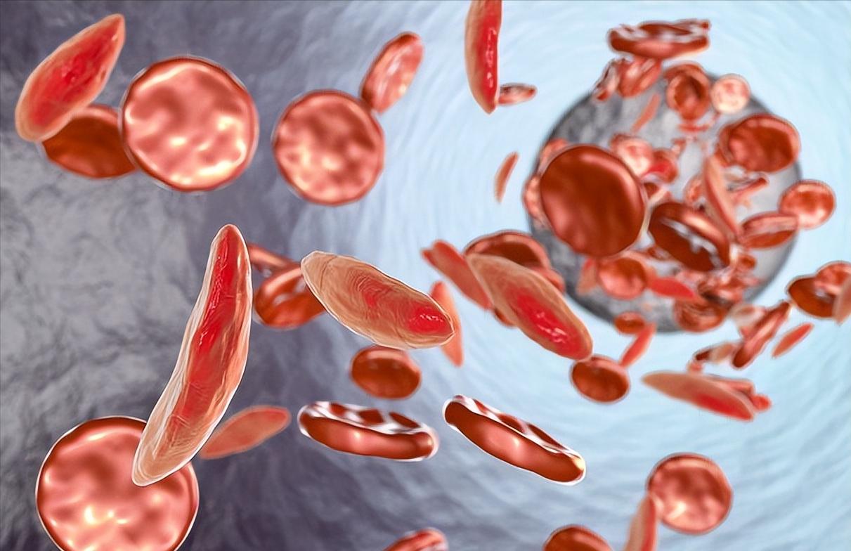 女子头晕胸闷,以为心肺不好,医生看到她的指甲怀疑子宫肌瘤