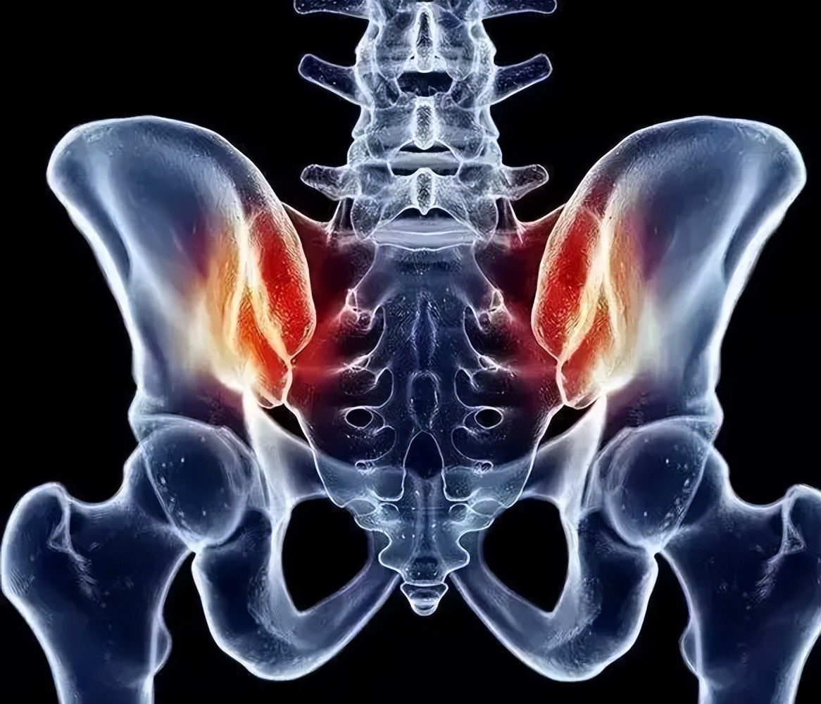 骨盆后环损伤后，新型螺钉的不同内固方法各有何优势？哪种方法好