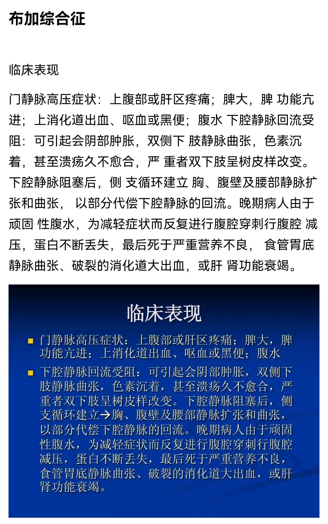 双下肢水肿心源性,心衰双下肢水肿