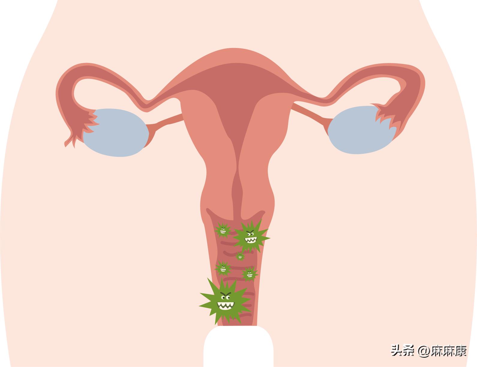 产后女性性功能障碍有哪些？怎么解决？