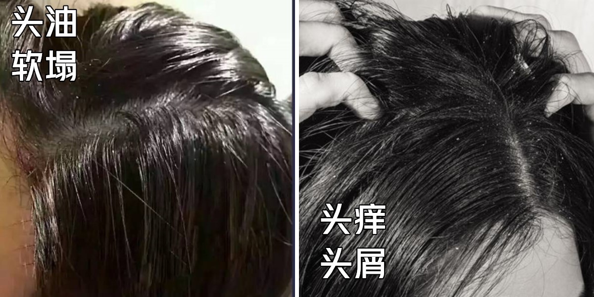 舒蕾洗发水红瓶白瓶哪款好,舒蕾洗发水哪一款是亮晶晶的