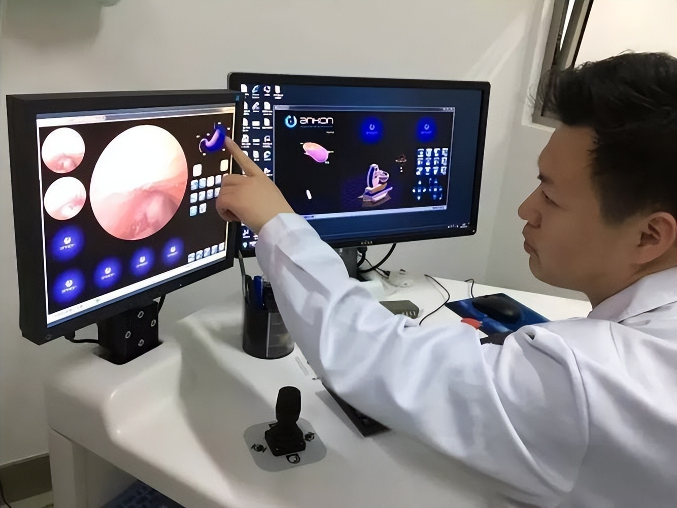 做了一年胃镜还有必要做胃镜吗,为什么要做胃镜胃镜有何神奇之处