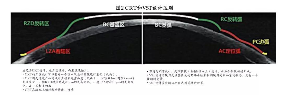 角膜塑形镜市场前景,角膜塑形镜公司排名