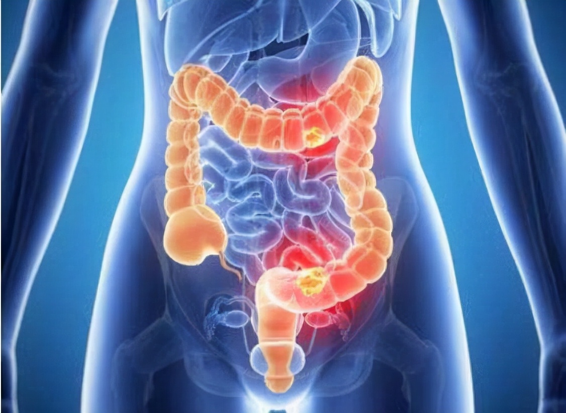 几块钱的甲硝唑可以治疗咽炎吗,消炎药甲硝唑都对哪些疾病消炎