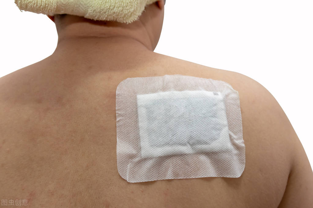 随手一贴就完事？贴膏药勿随意