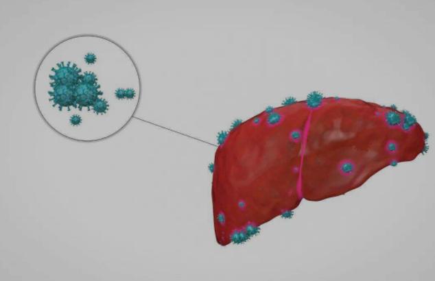 家有乙肝病人其他人怎么办,与乙肝患者接触如何避免被感染