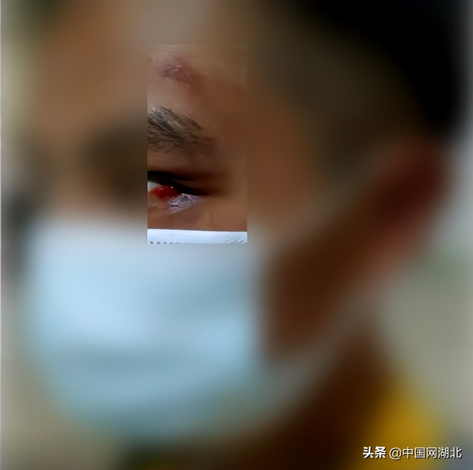 校园霸凌抽皮带,学生被霸凌三年校方回应