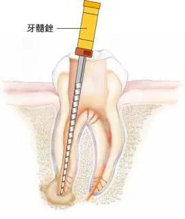 痛得无法入眠怎么办,痛得不能睡觉
