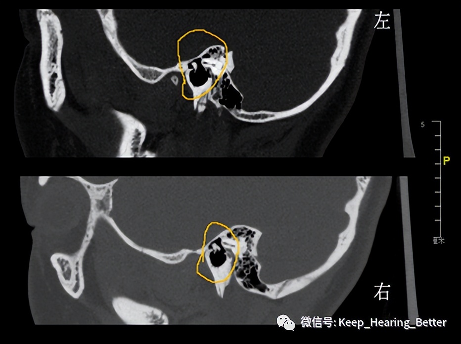 南昌大学第一附属医院鼓膜修复,南昌大学二附院耳鼻喉科专家介绍