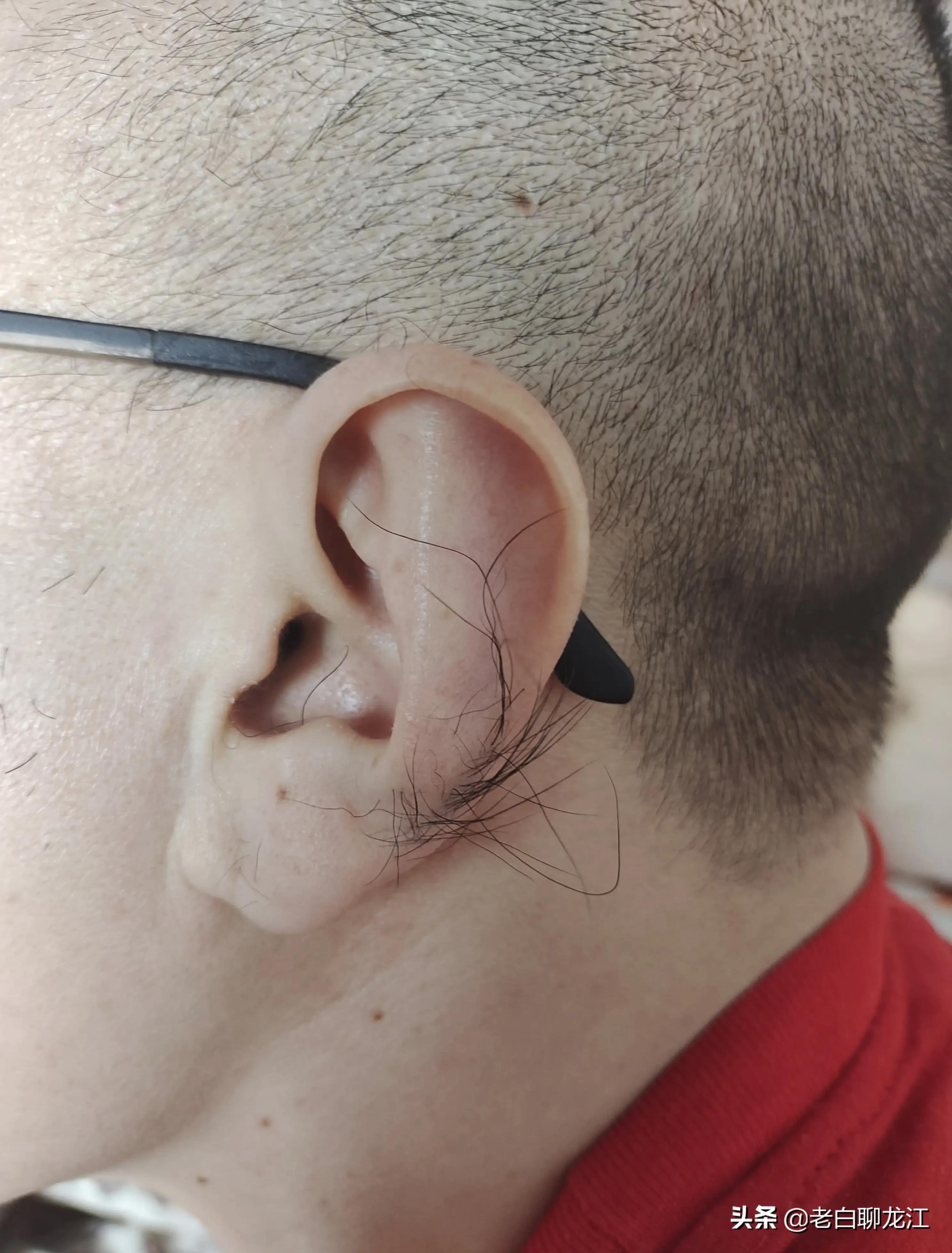 人能动耳朵是特异功能吗,耳朵能动是什么症状