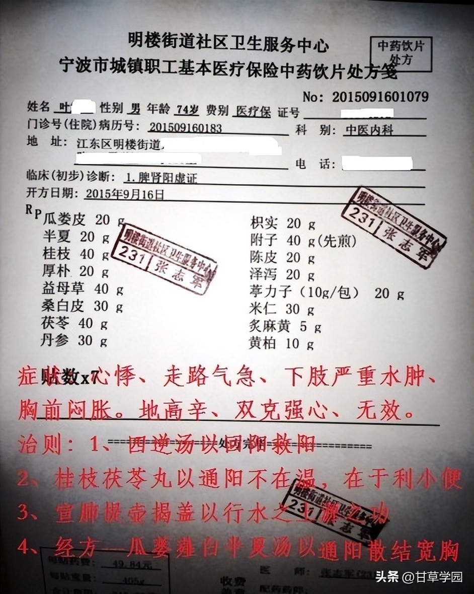 甘草芍药附子汤治静脉曲张医案,甘草芍药汤治疗静脉曲张医案