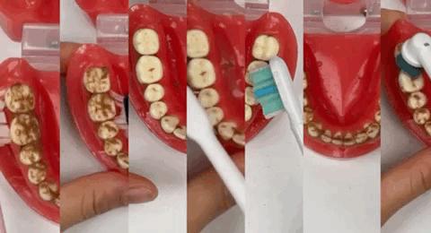 电动牙刷如何选购,怎样选择较好的电动牙刷