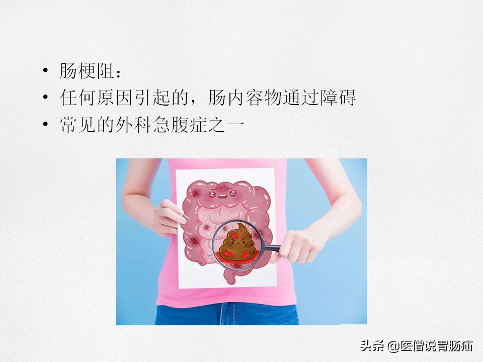 肠梗阻健康教育,肠梗阻患者的健康宣教