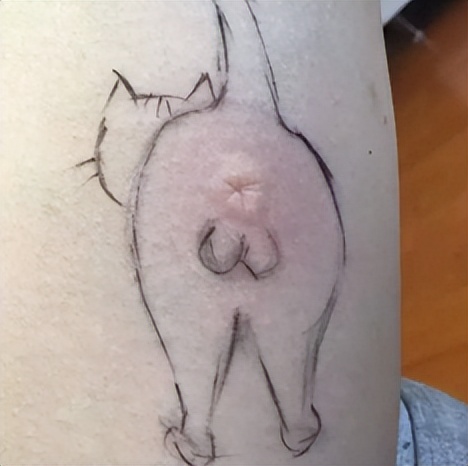 被蚊子咬掐十字止痒法,被蚊子叮咬后掐十字有用吗