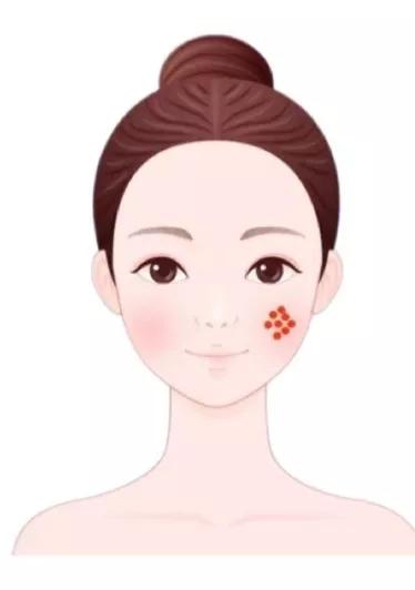 脸上有痘生活小妙招,你有什么方法改善脸上的痘痘