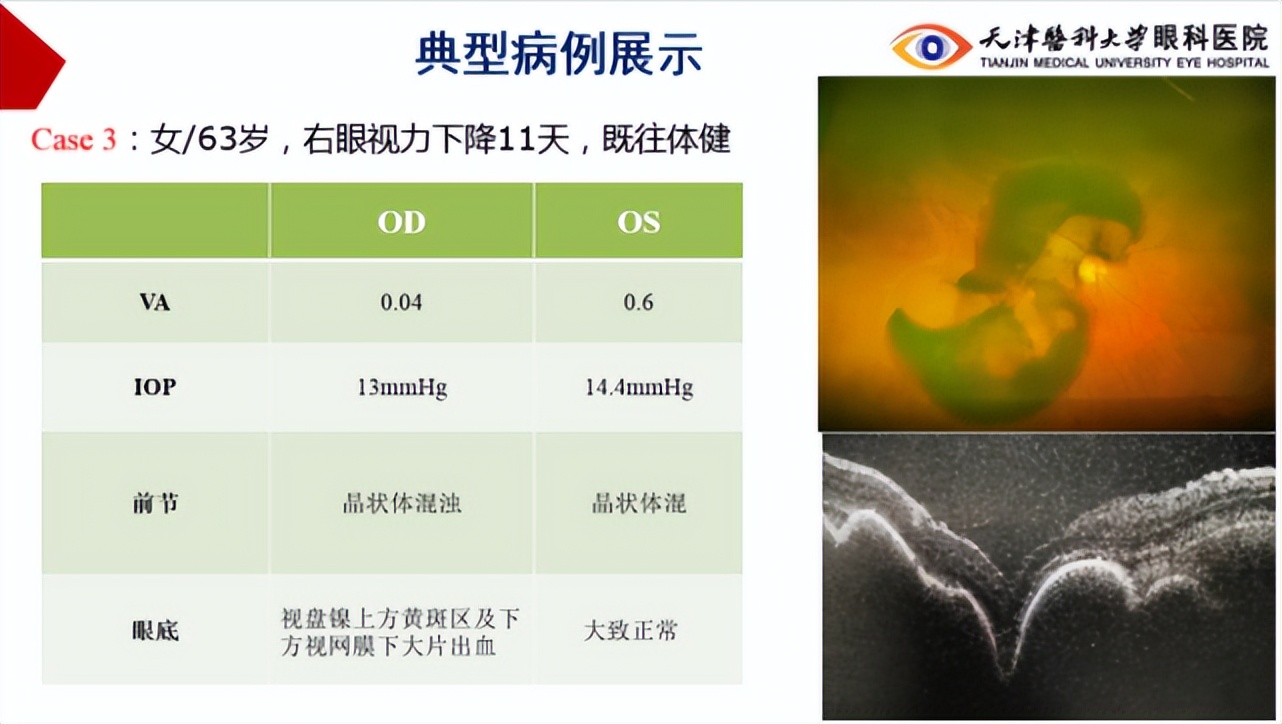 李筱荣教授,天津医科大学眼科医院李筱荣