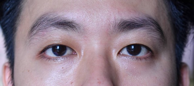 女人出现黑眼圈的原因,出现黑眼圈是怎么回事