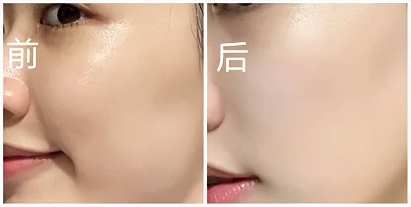 祛痘修护面膜测评红榜,好用的美白祛斑面膜测评