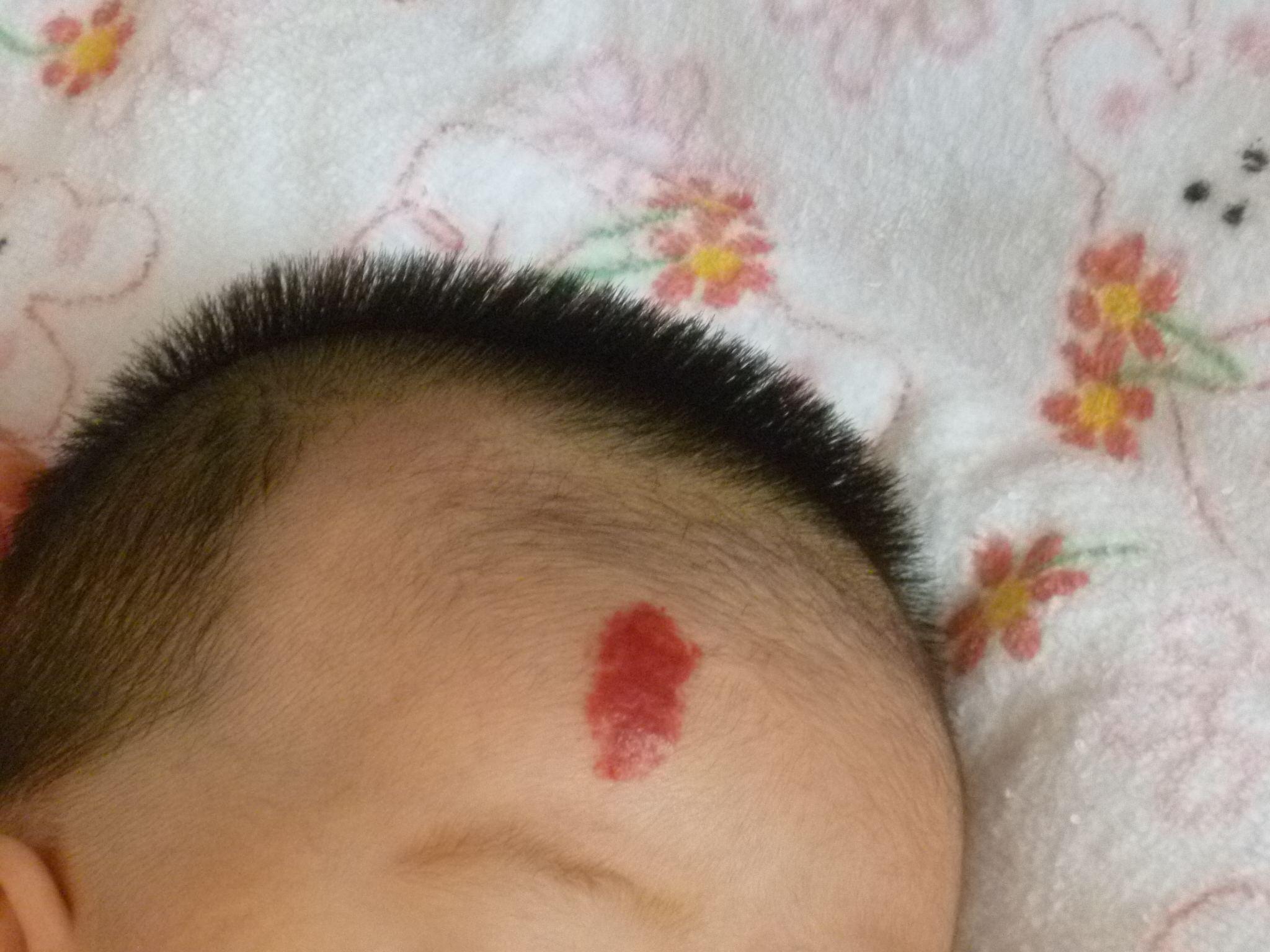 孩子身上出现不明红点,0-6岁的宝宝家长都应该关注哪些